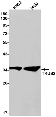 Rabbit monoclonal antibody