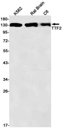 Rabbit monoclonal antibody