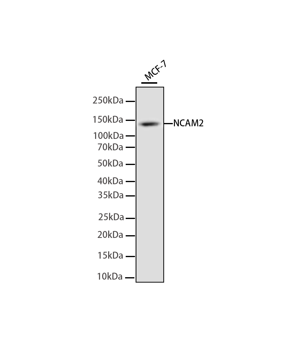 Rabbit monoclonal antibody