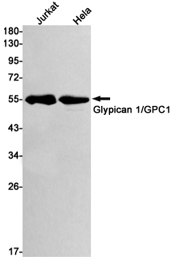 GPC1 Rabbit mAb