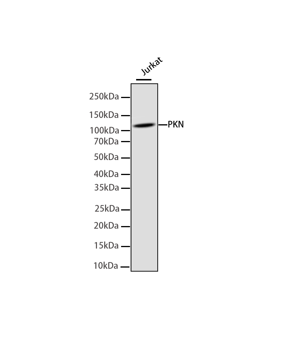Rabbit monoclonal antibody