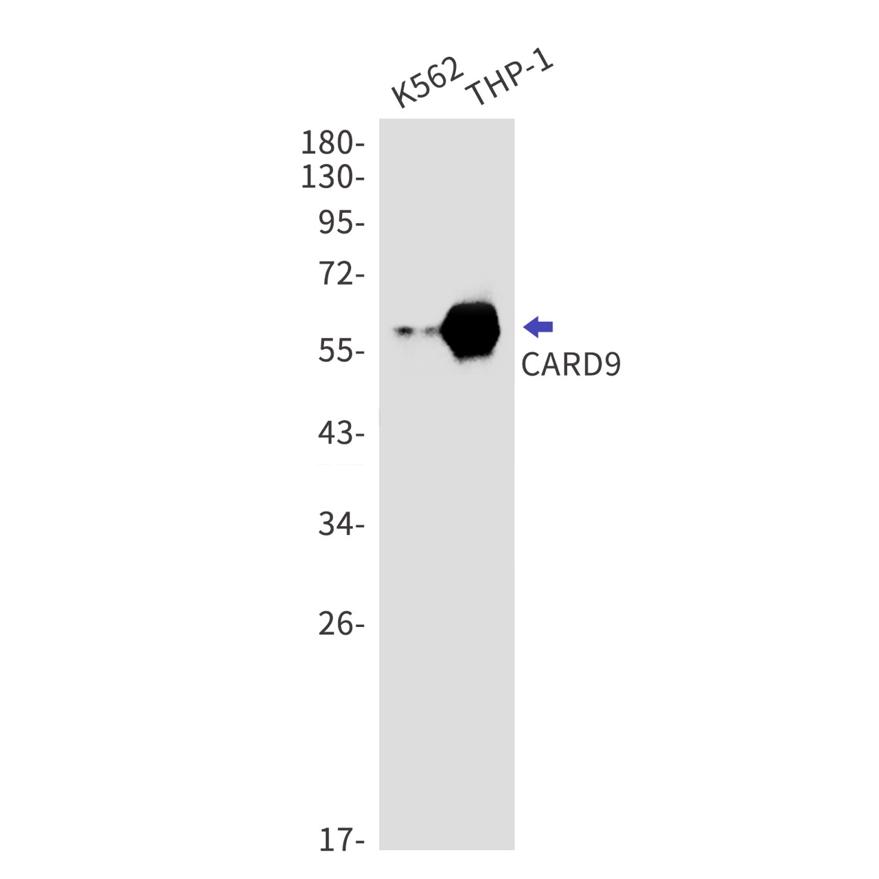 Rabbit monoclonal antibody