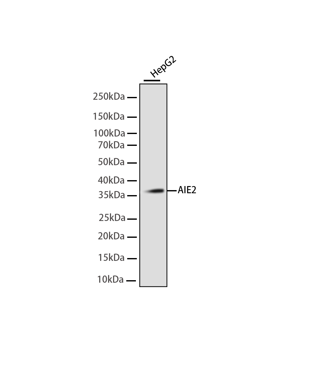 Rabbit monoclonal antibody