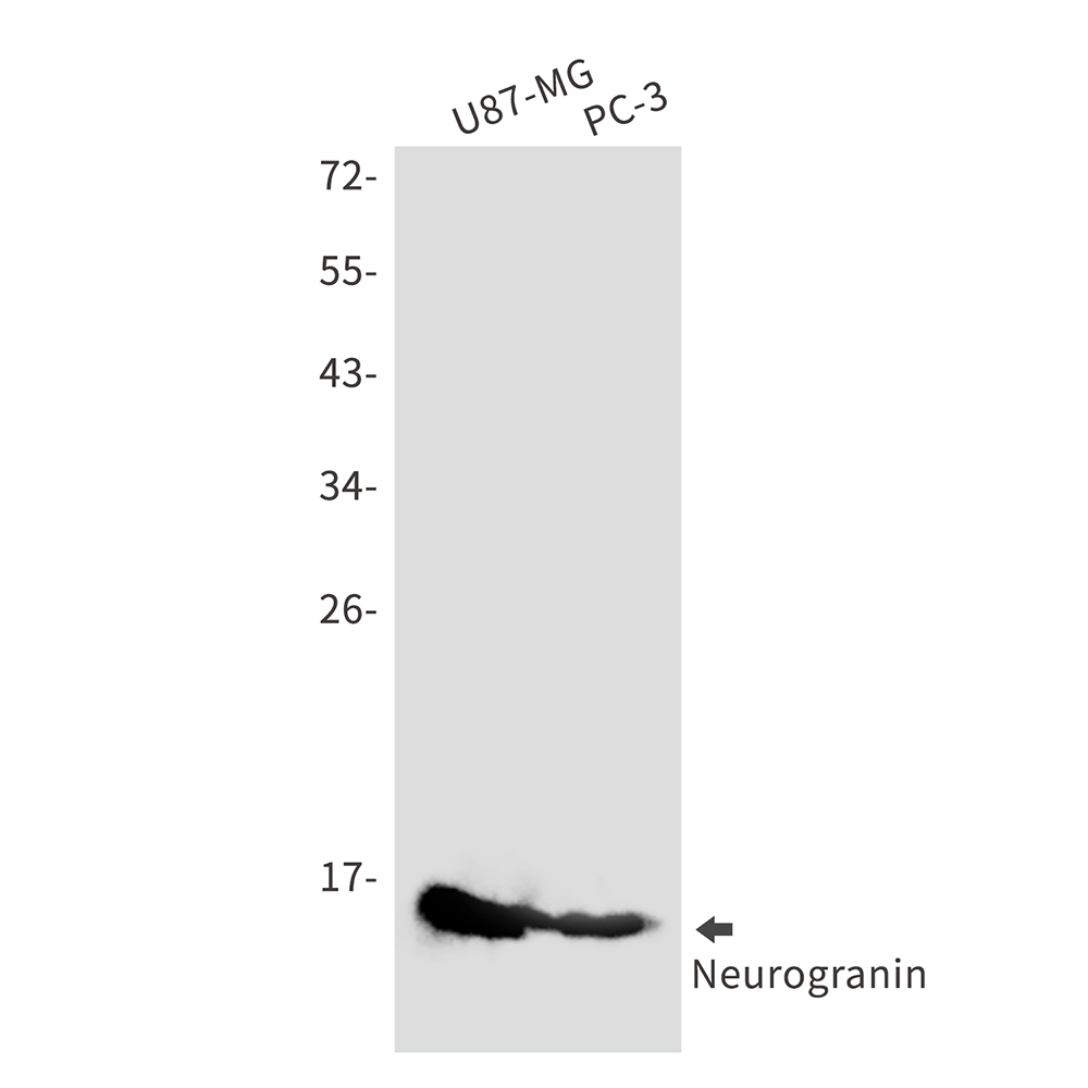 Rabbit monoclonal antibody