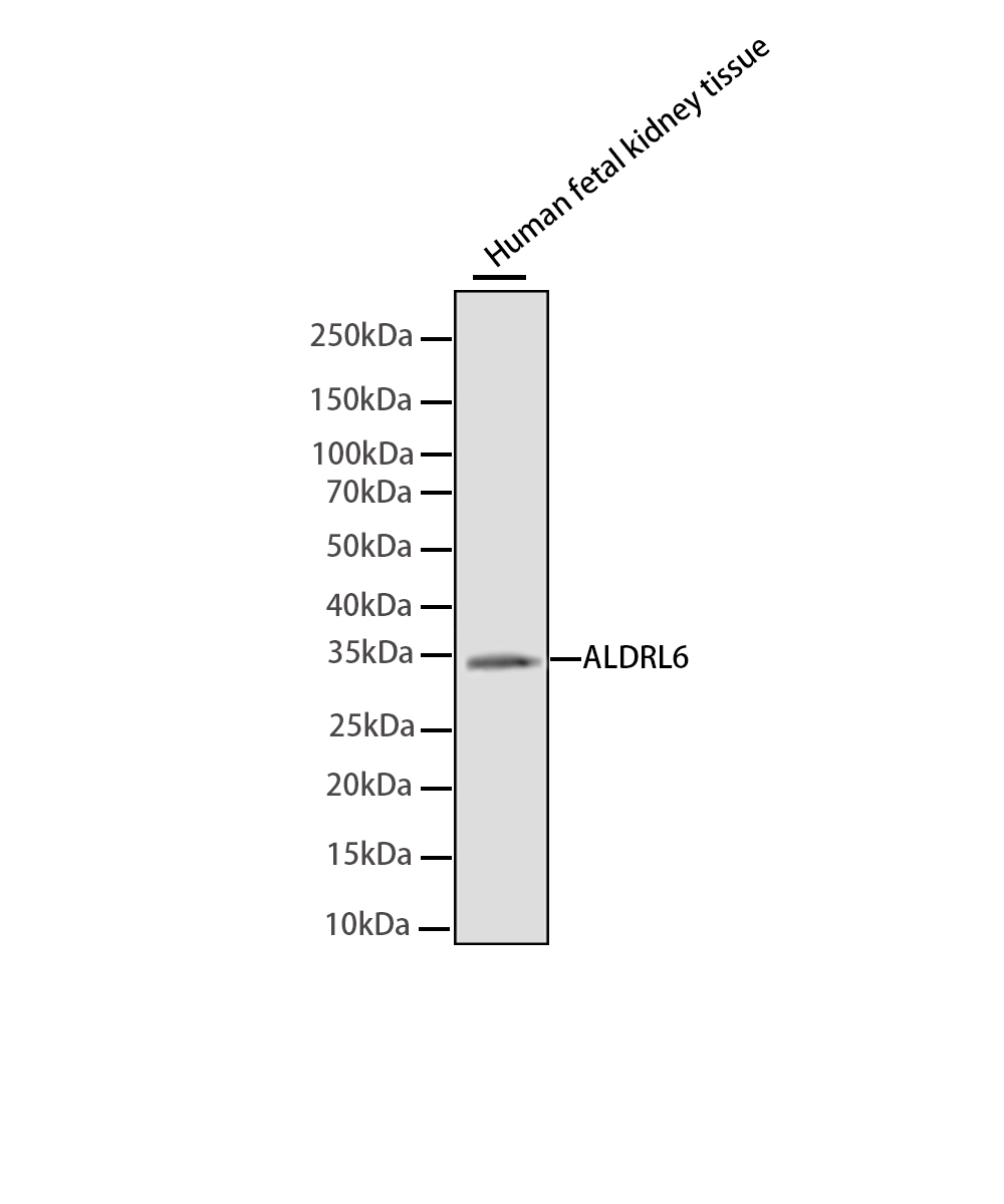 Rabbit monoclonal antibody