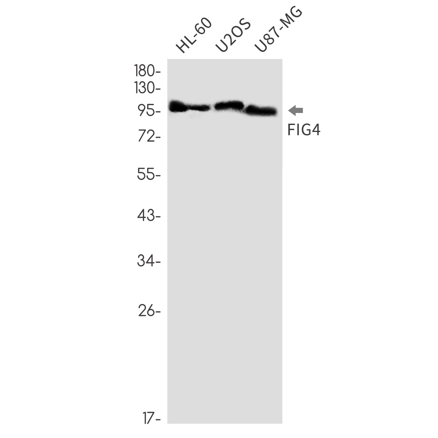 Rabbit monoclonal antibody