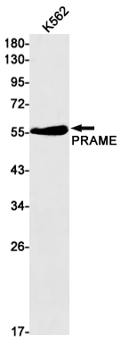 Rabbit monoclonal antibody