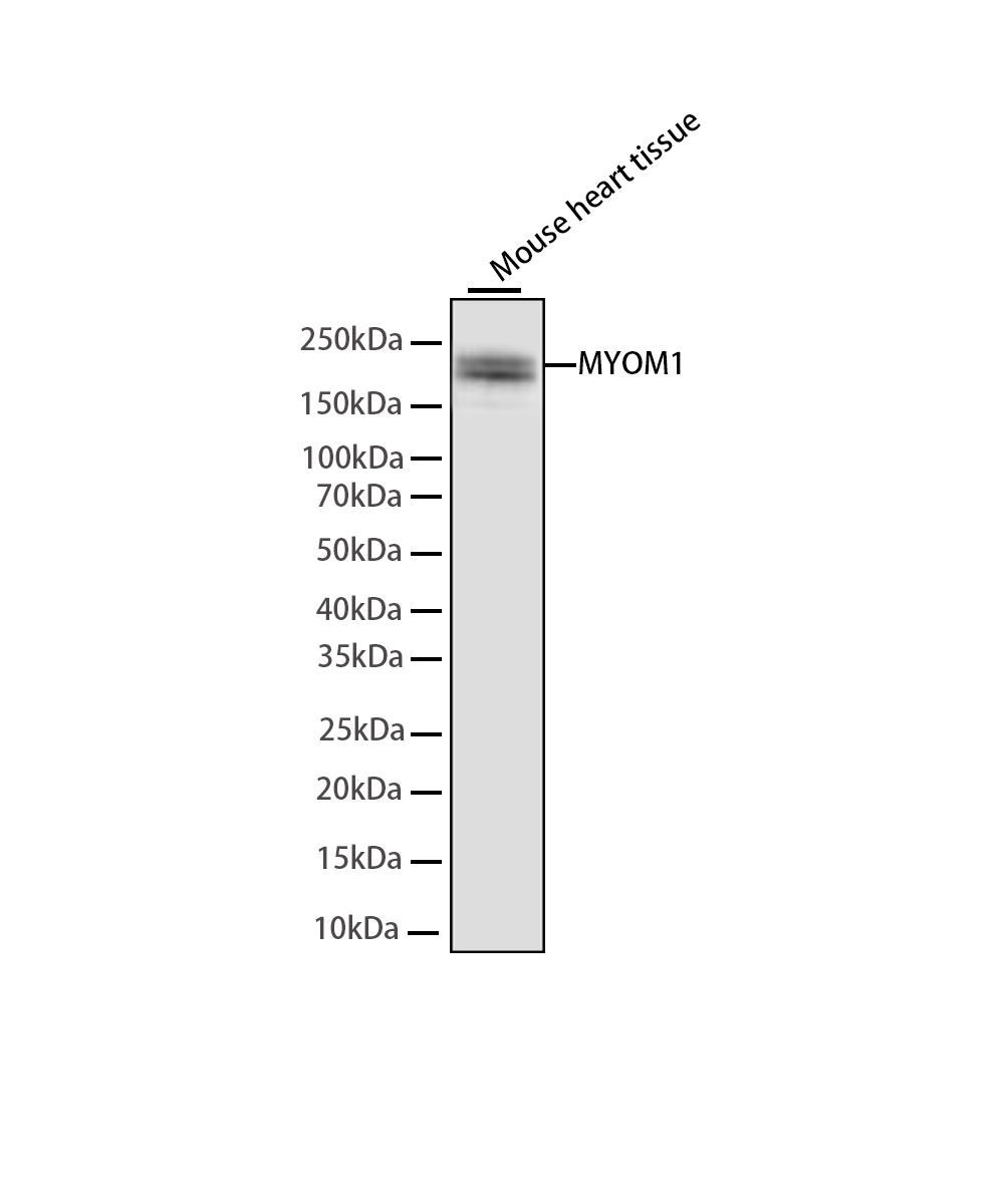 Rabbit monoclonal antibody