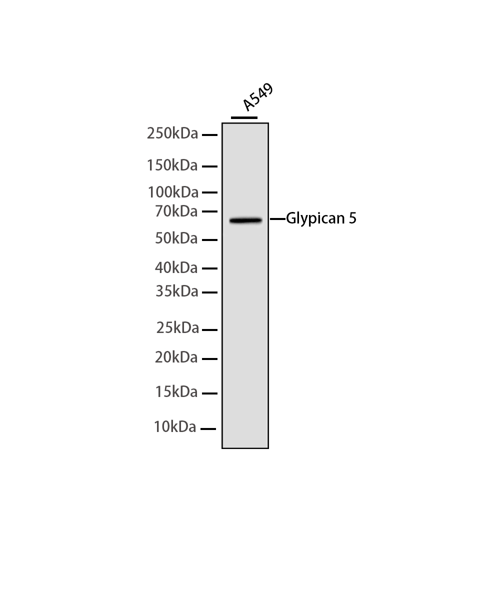 Rabbit monoclonal antibody