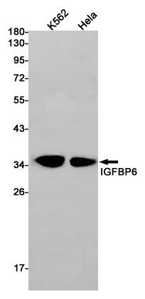 Rabbit monoclonal antibody