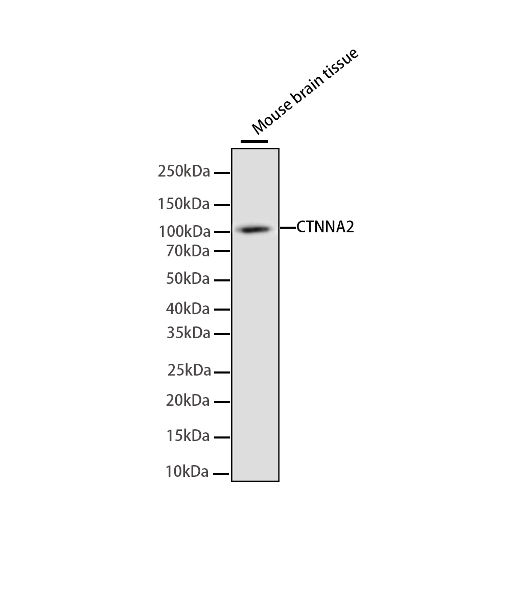 Rabbit monoclonal antibody