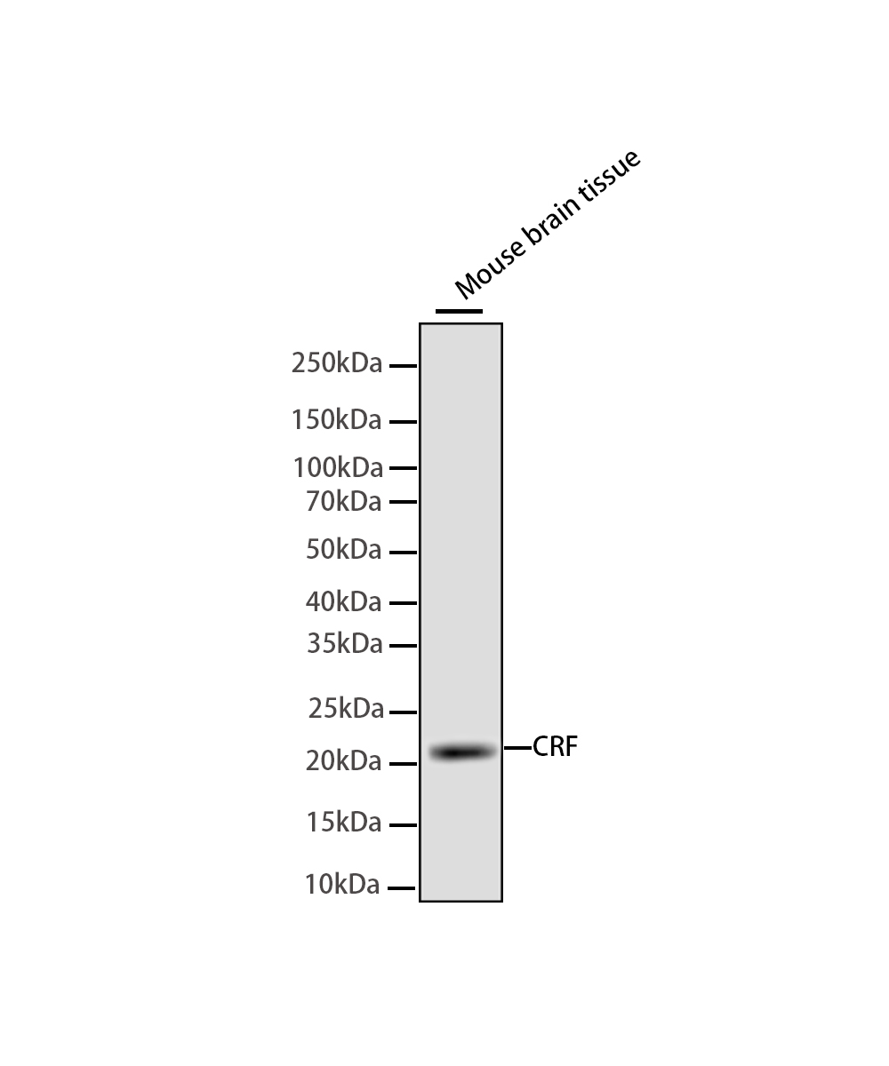 Rabbit monoclonal antibody