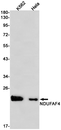 Rabbit monoclonal antibody