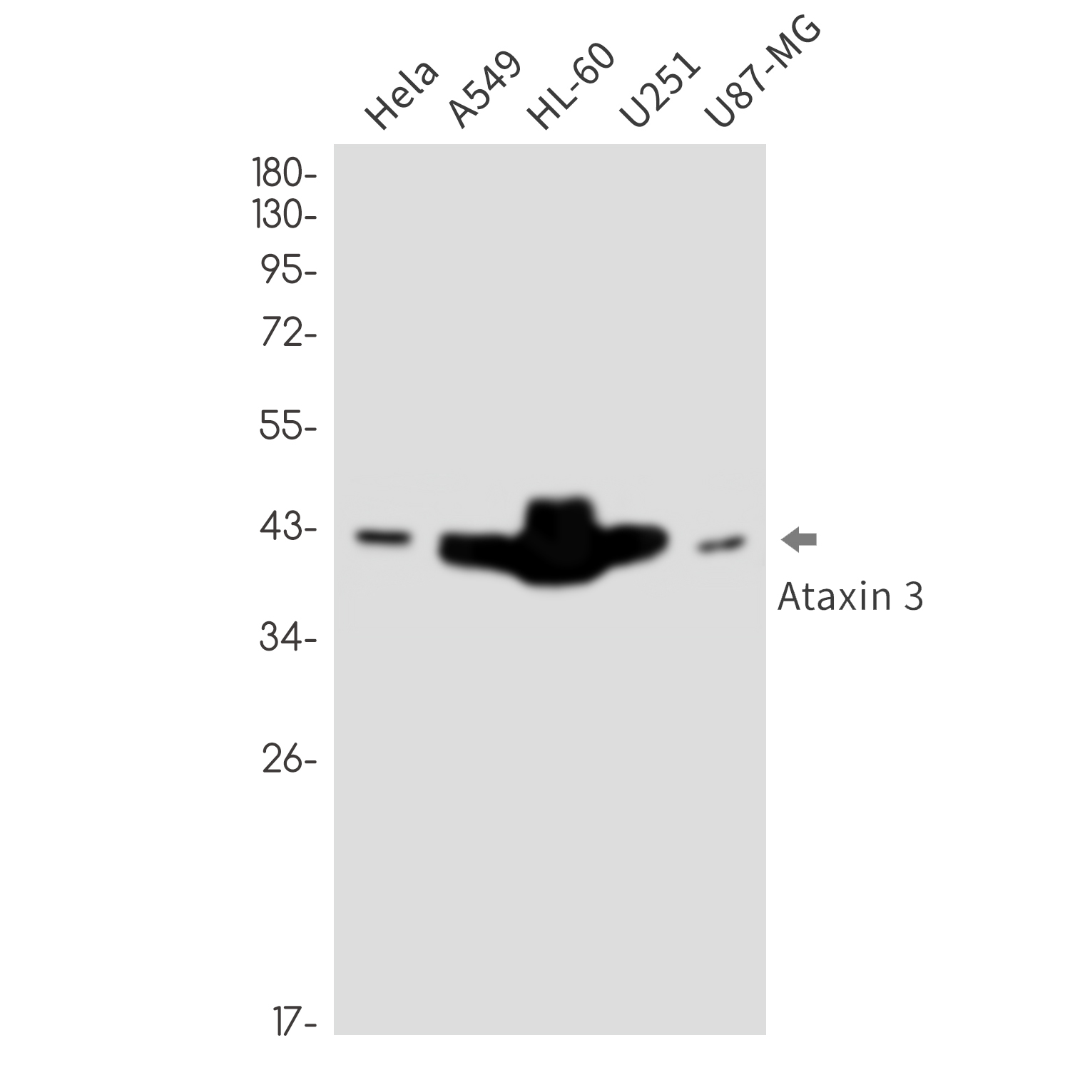 Rabbit monoclonal antibody