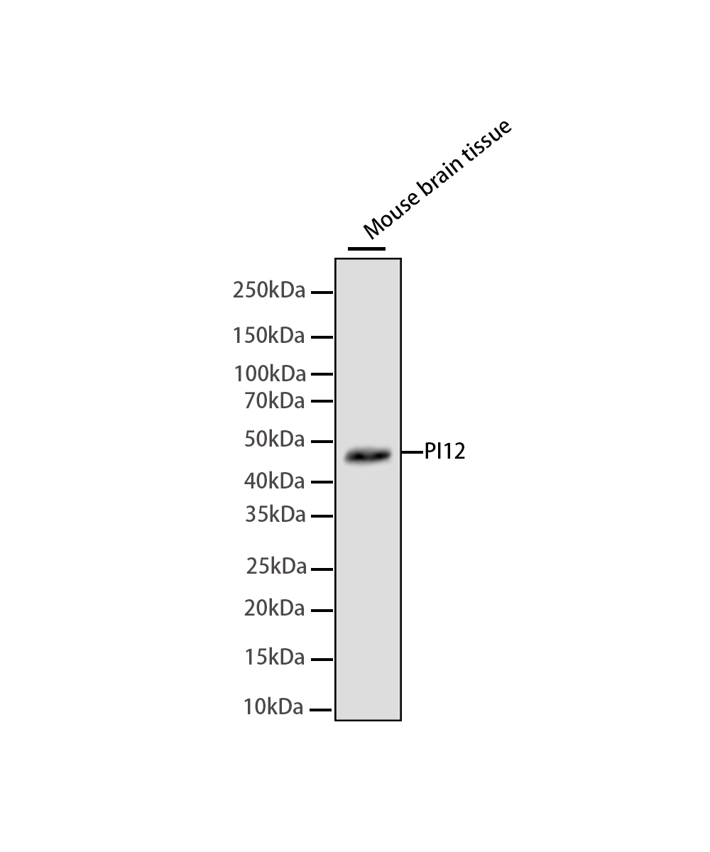 Rabbit monoclonal antibody