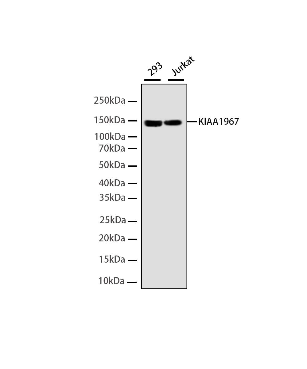 KIAA1967 Rabbit mAb