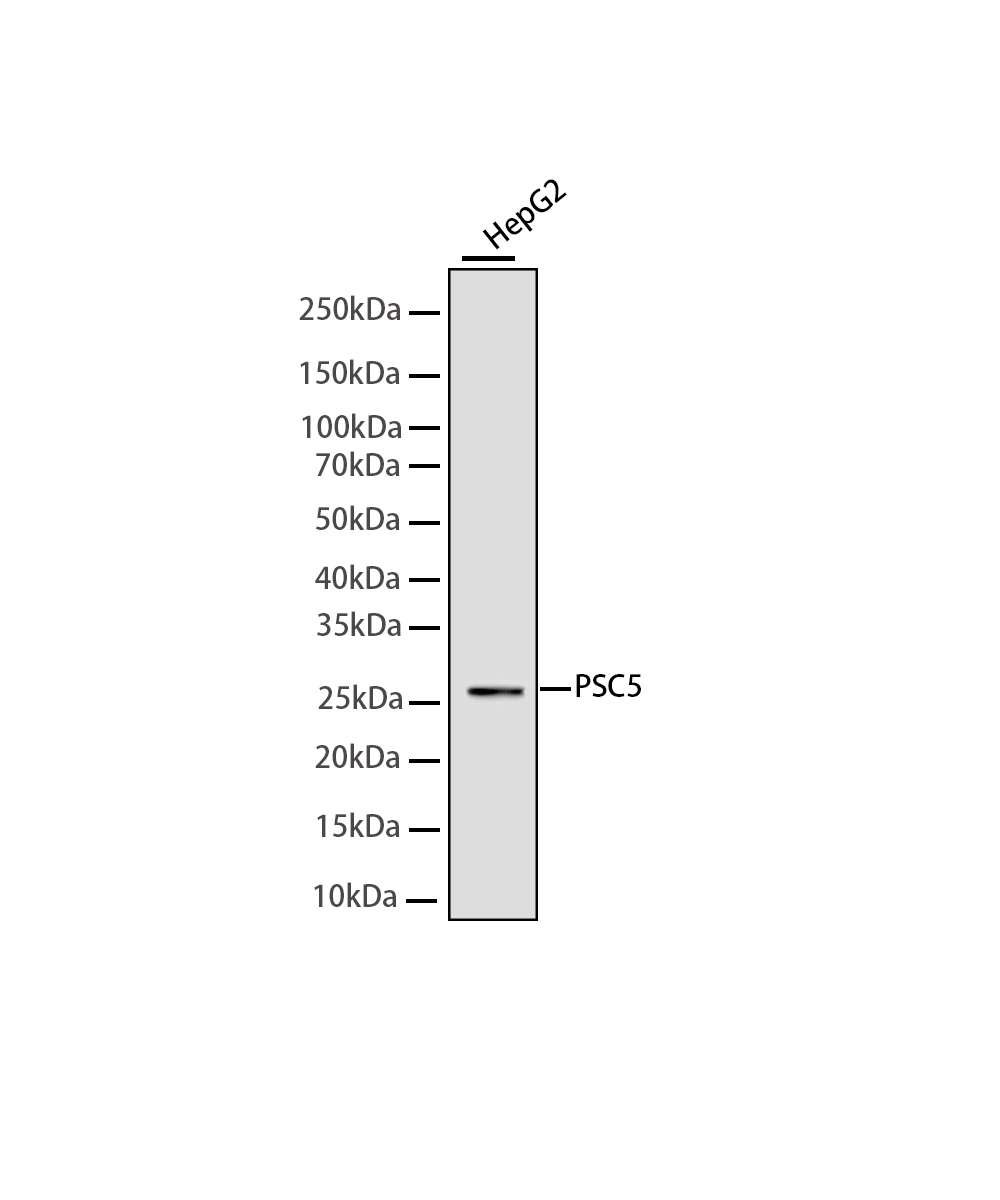 Rabbit monoclonal antibody