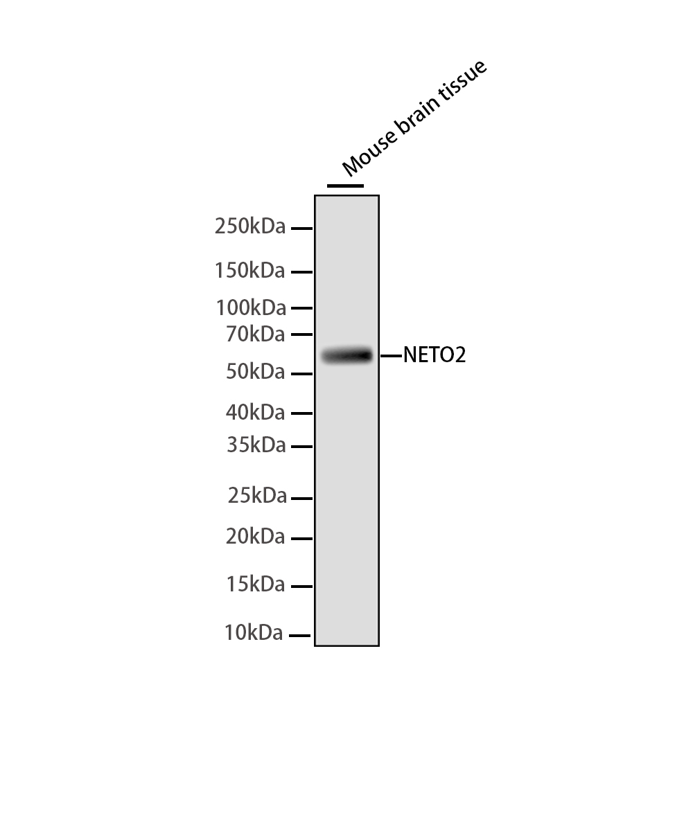 Rabbit monoclonal antibody