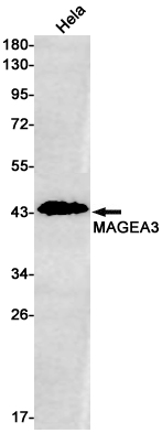 Rabbit monoclonal antibody