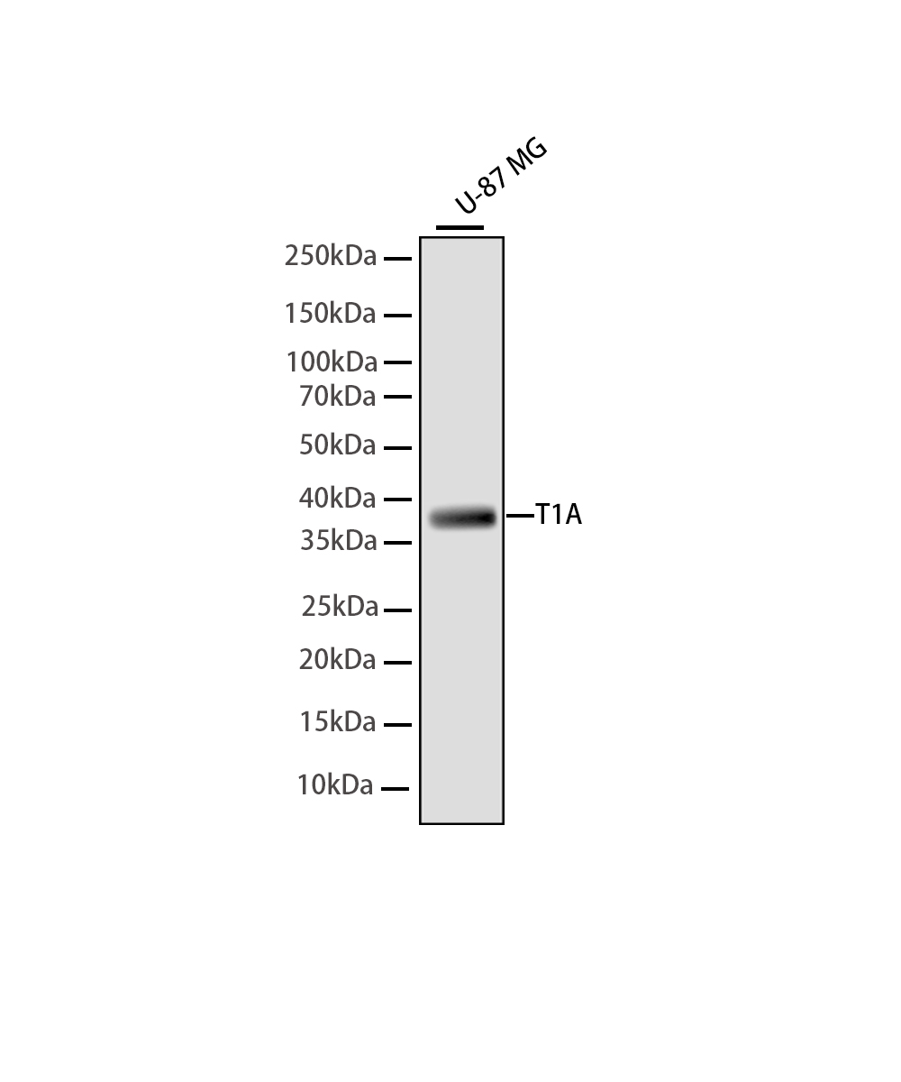 Rabbit monoclonal antibody