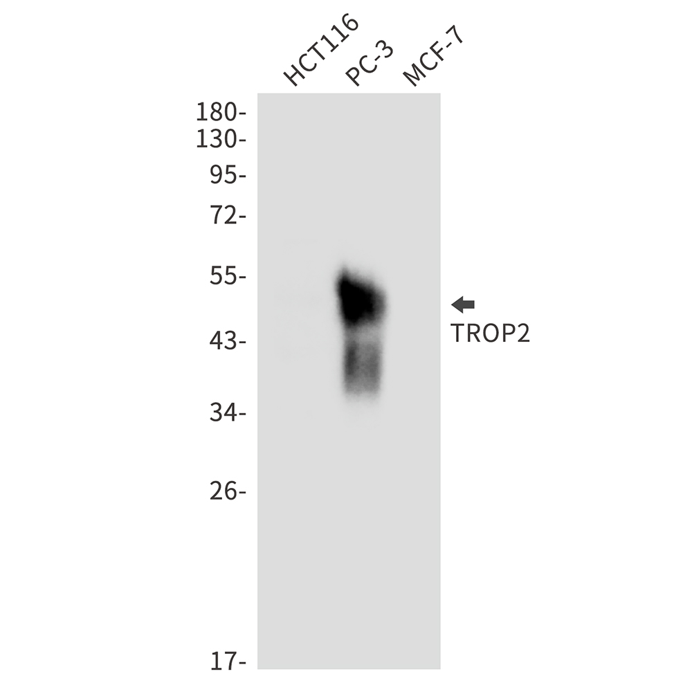 Rabbit monoclonal antibody