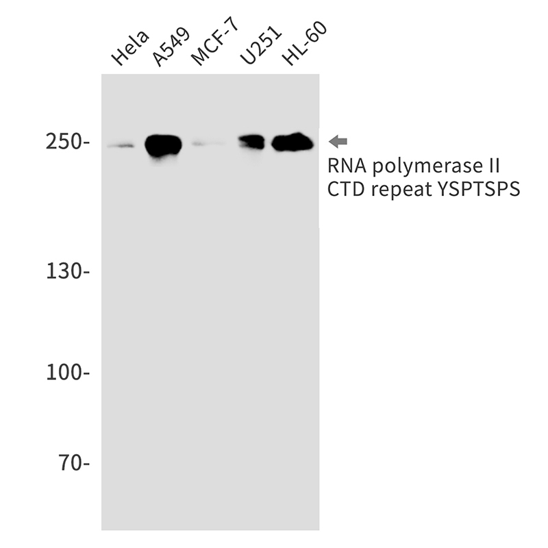 Rabbit monoclonal antibody