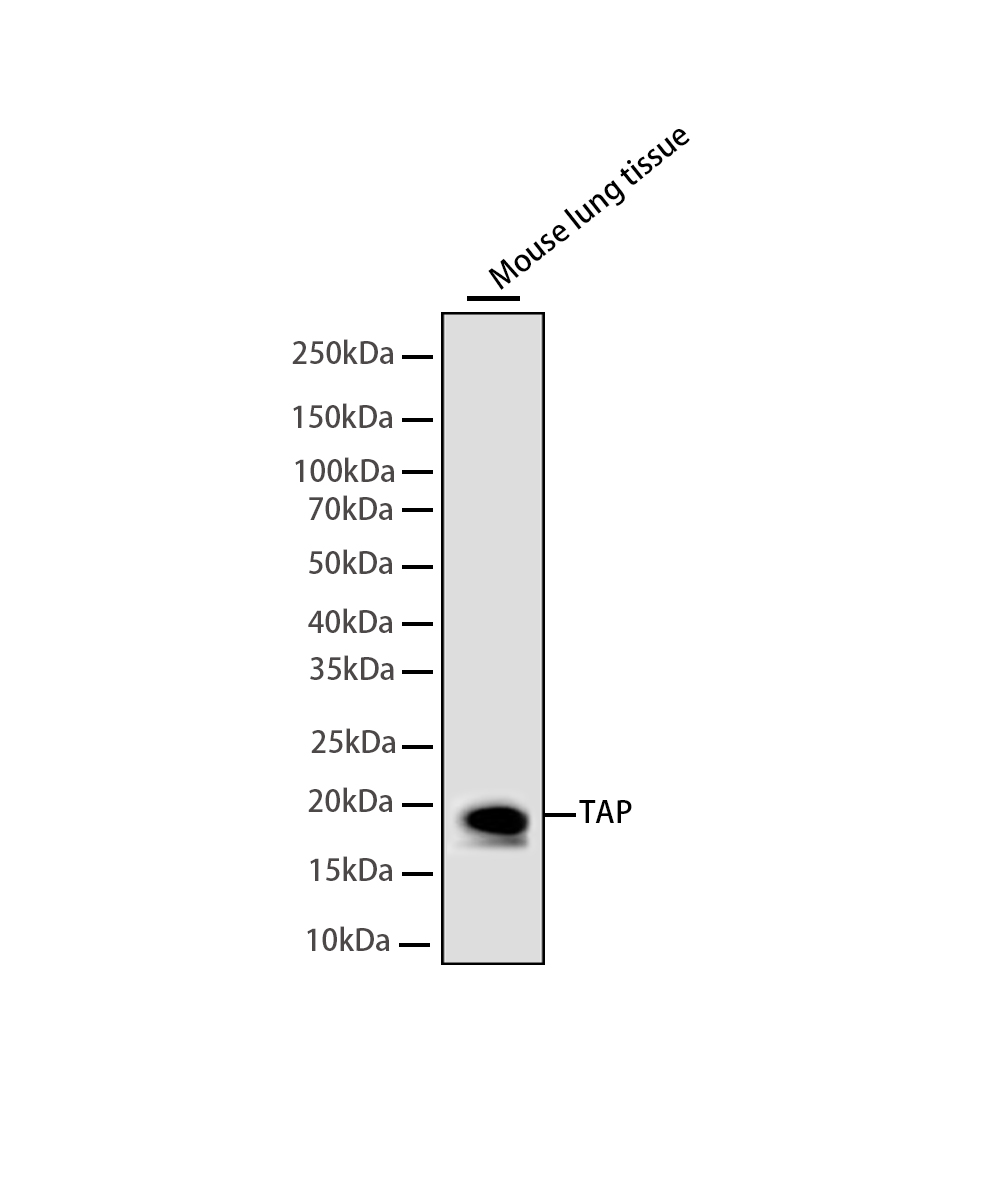 Rabbit monoclonal antibody