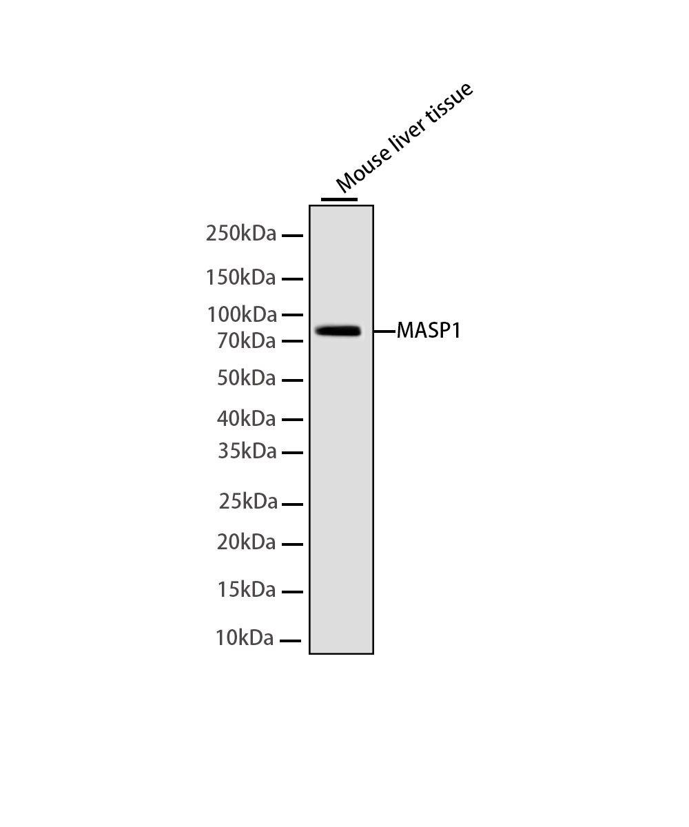 Rabbit monoclonal antibody