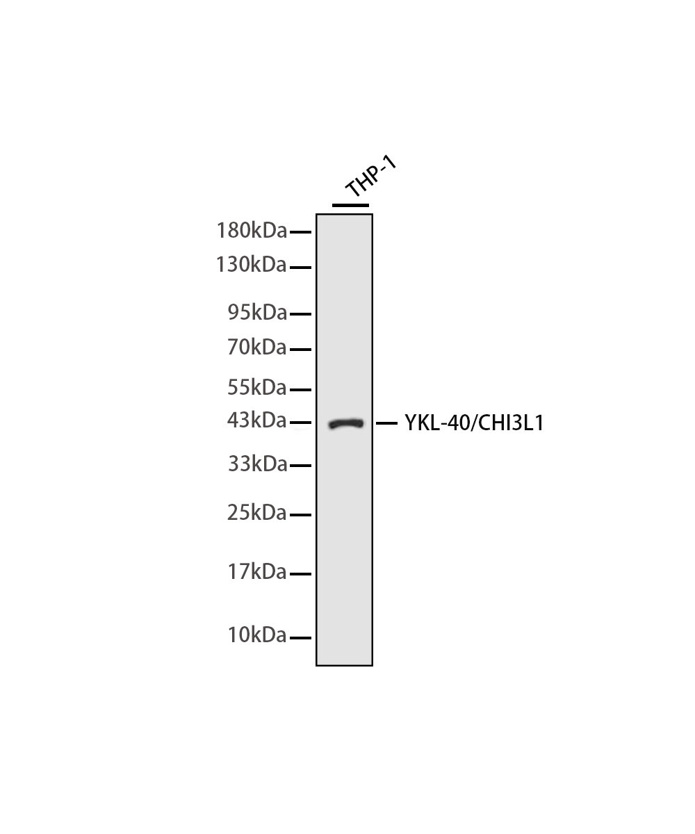 Rabbit monoclonal antibody