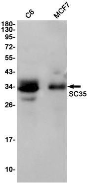 Rabbit monoclonal antibody