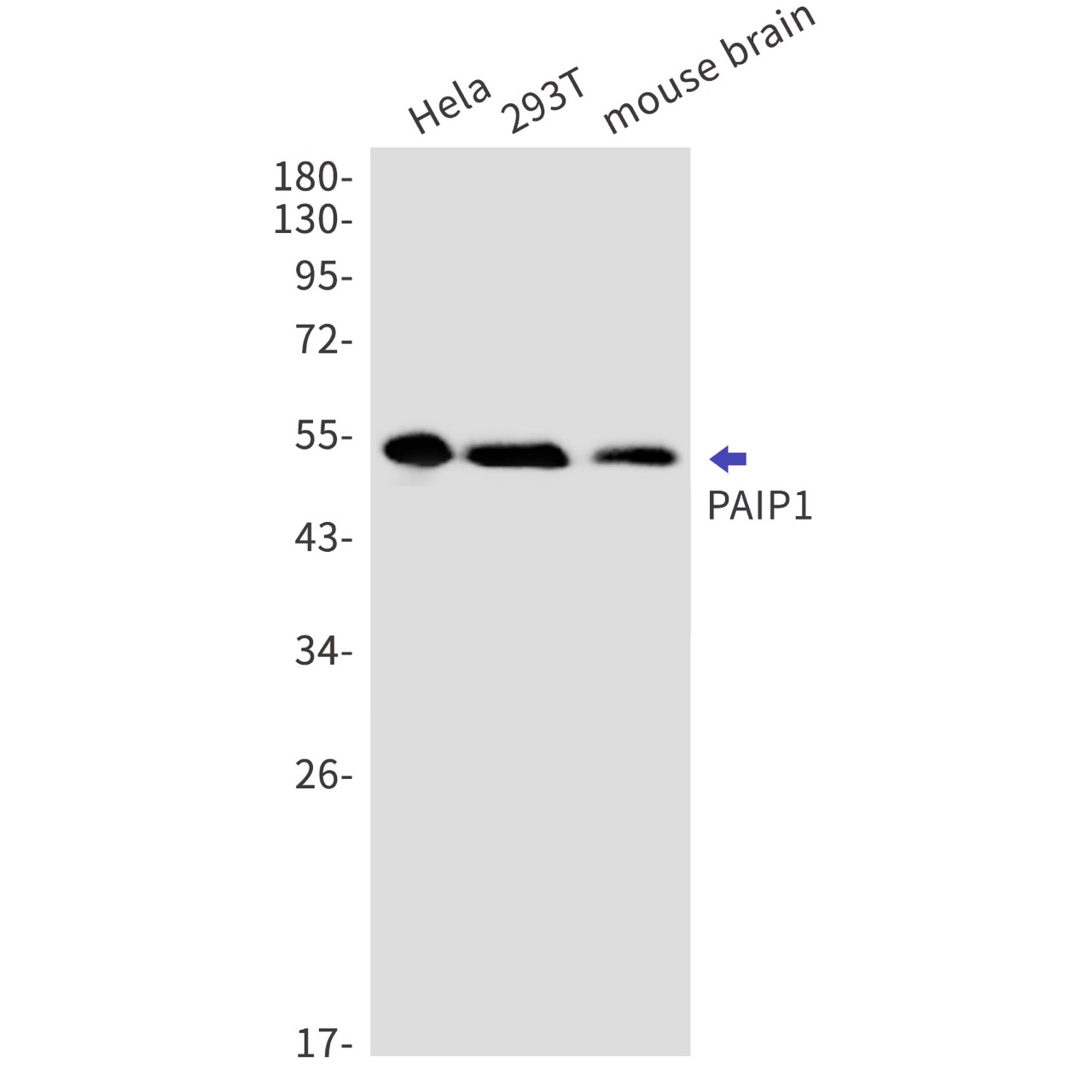 Rabbit monoclonal antibody