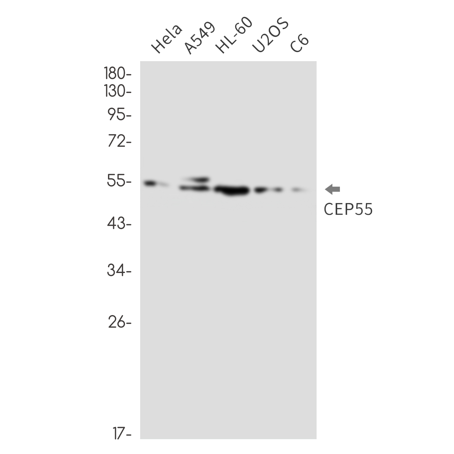 Rabbit monoclonal antibody