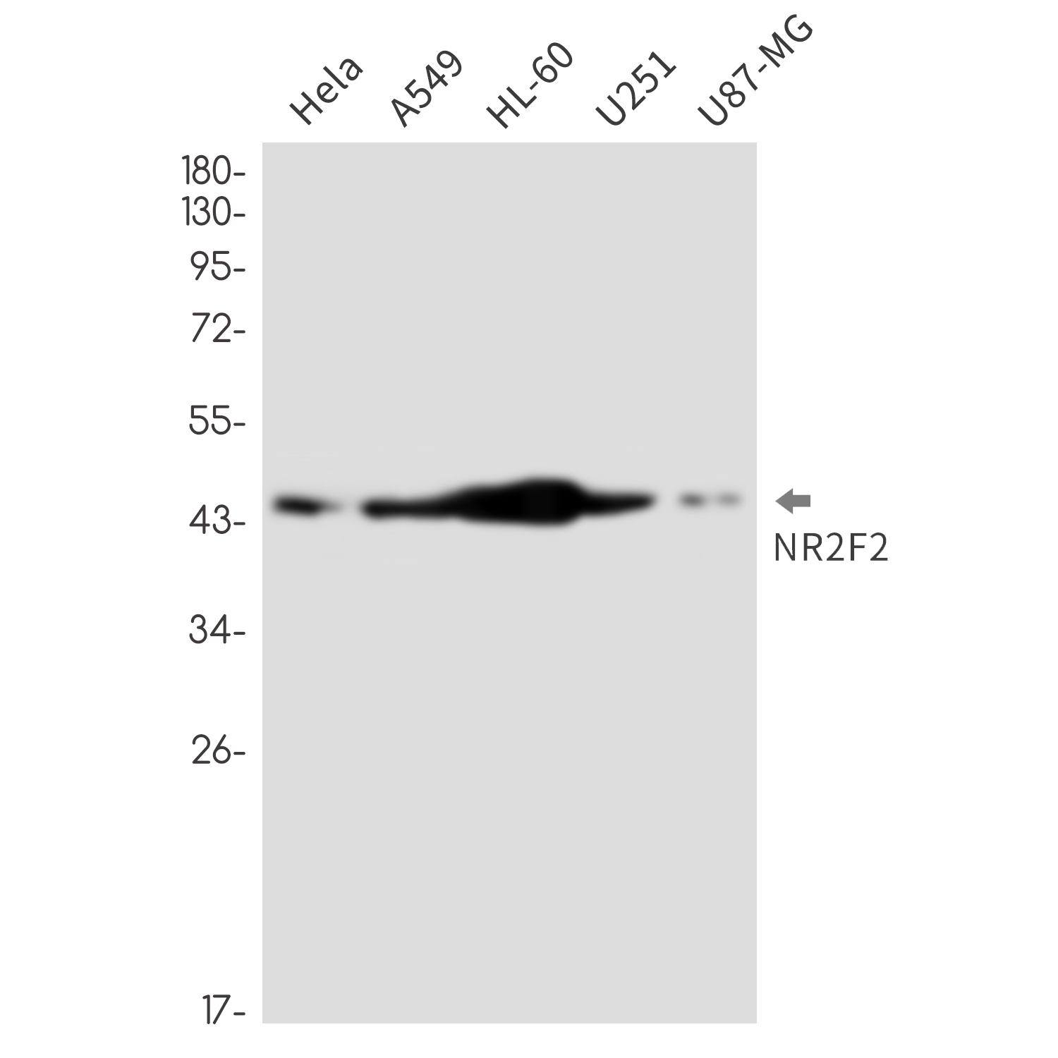 Rabbit monoclonal antibody