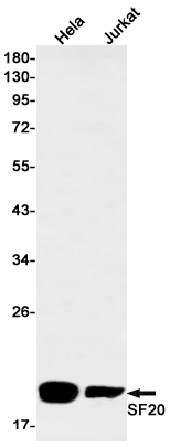 Rabbit monoclonal antibody