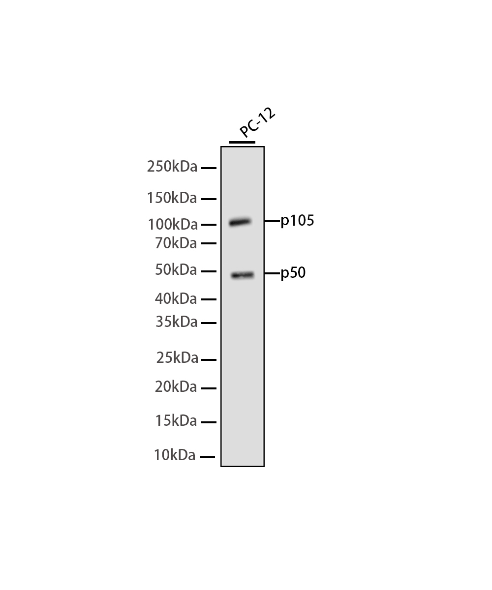 Rabbit monoclonal antibody