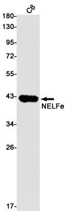 Rabbit monoclonal antibody