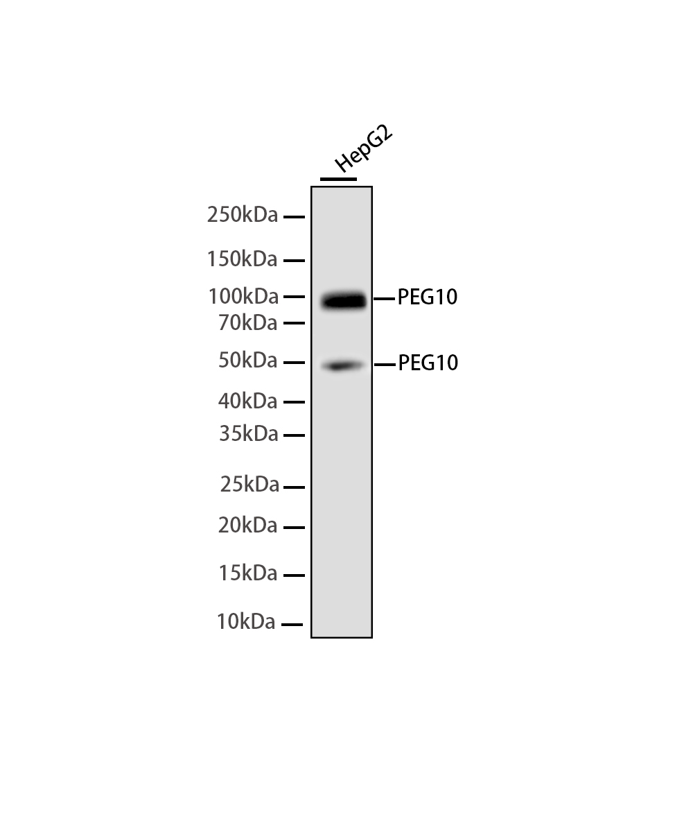 Rabbit monoclonal antibody