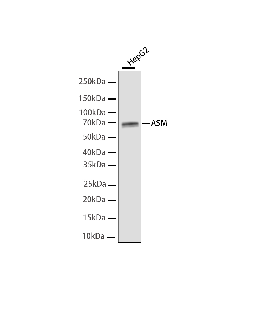 Rabbit monoclonal antibody