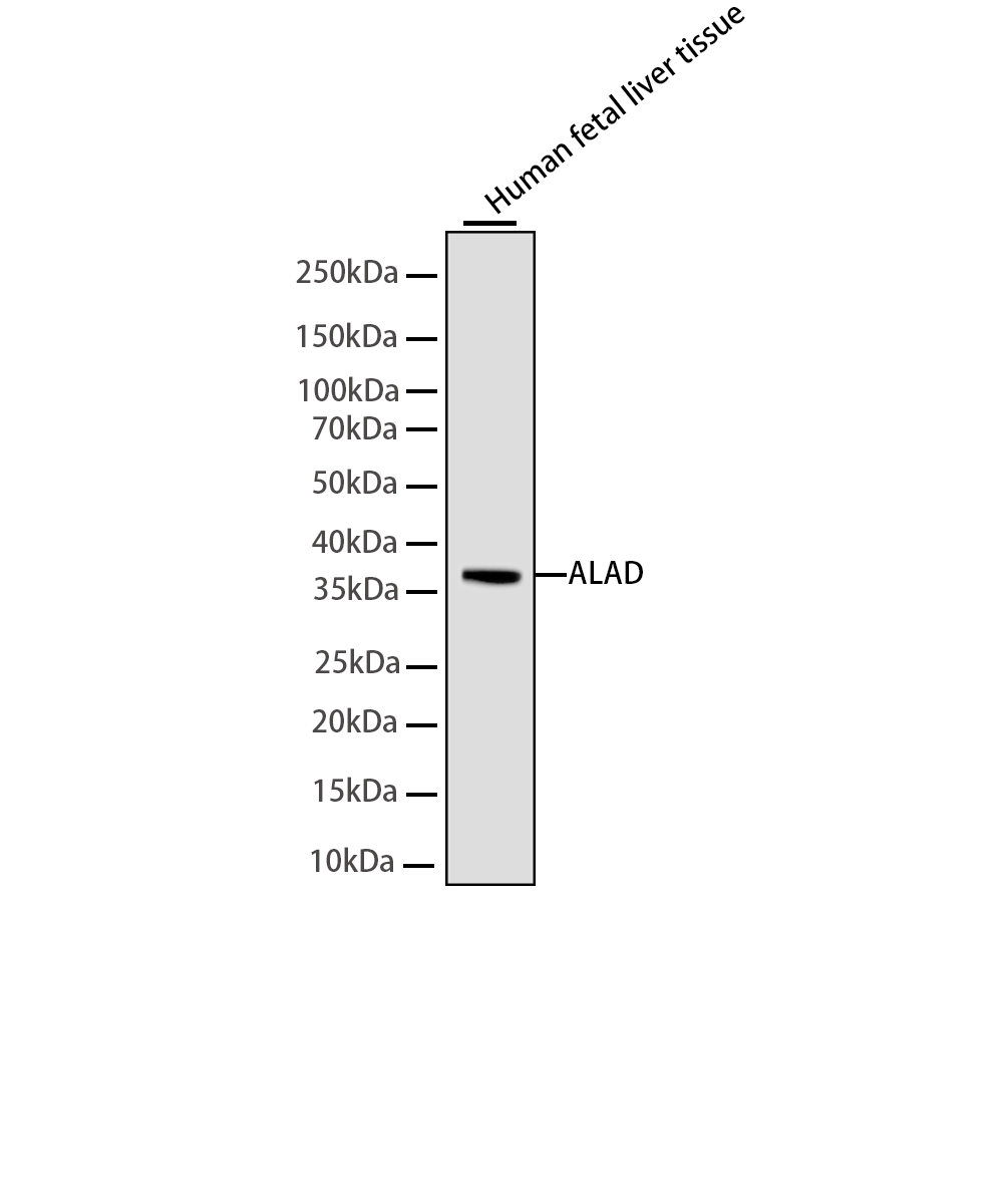 Rabbit monoclonal antibody