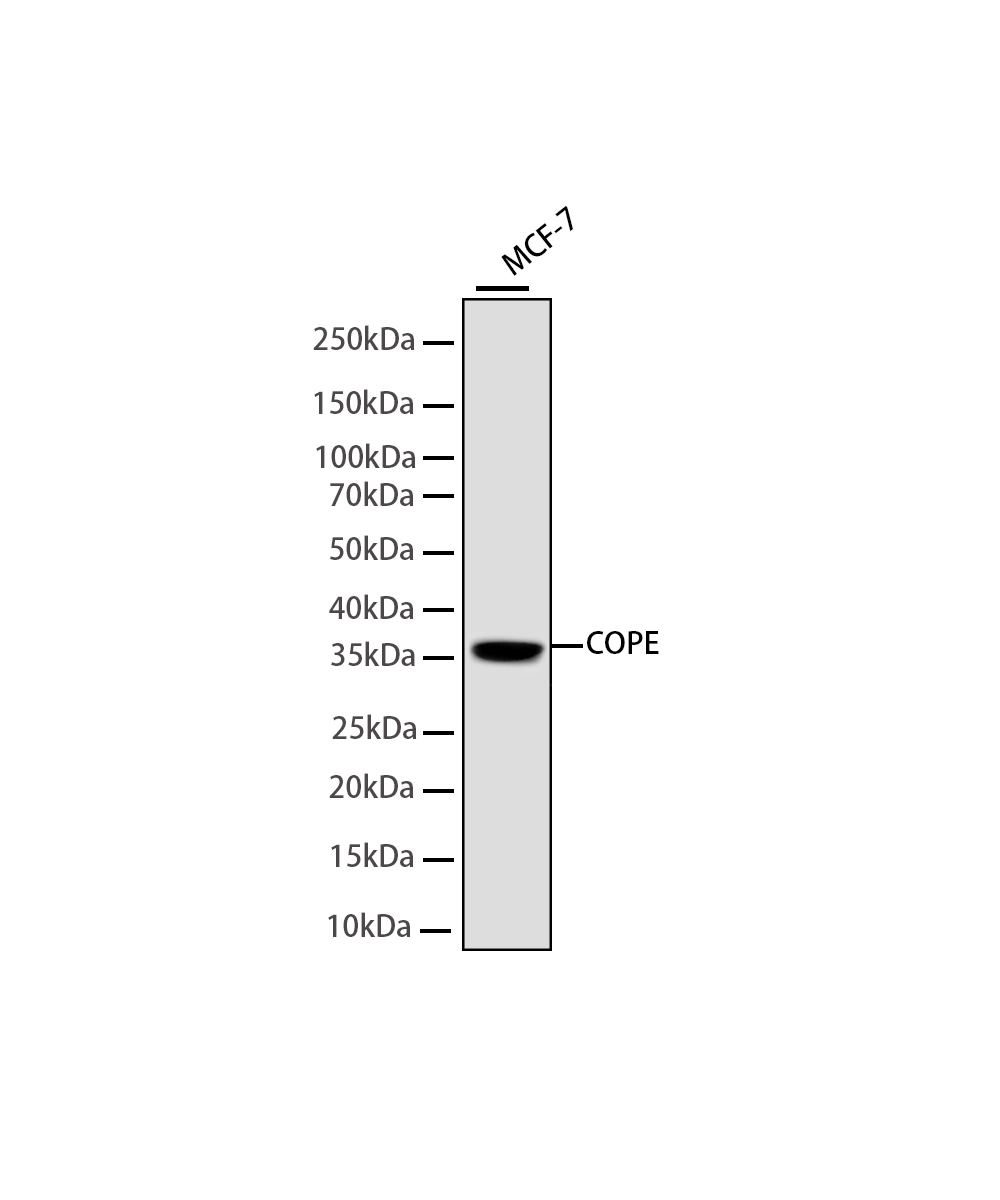 Rabbit monoclonal antibody