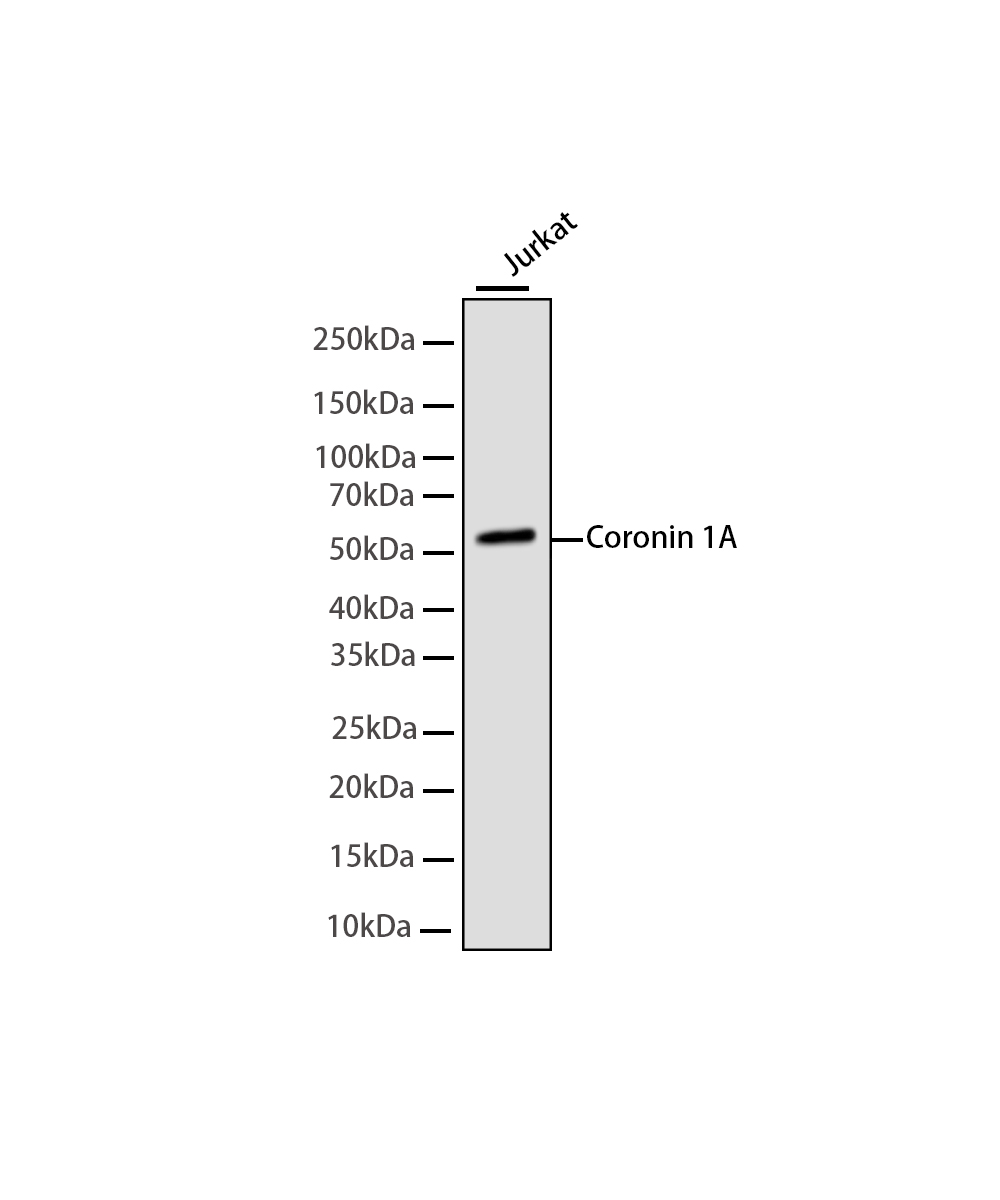Rabbit monoclonal antibody