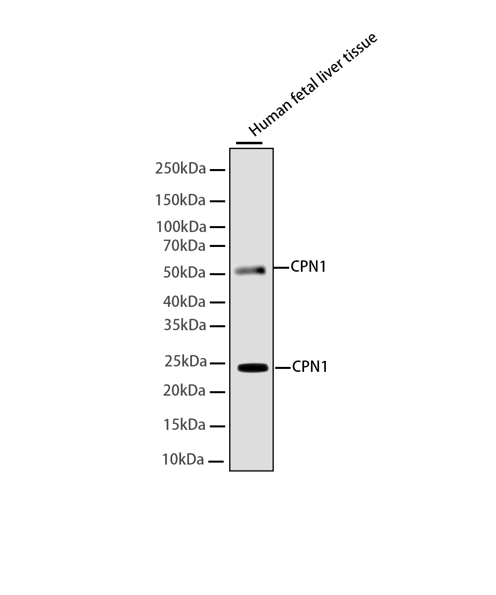 Rabbit monoclonal antibody