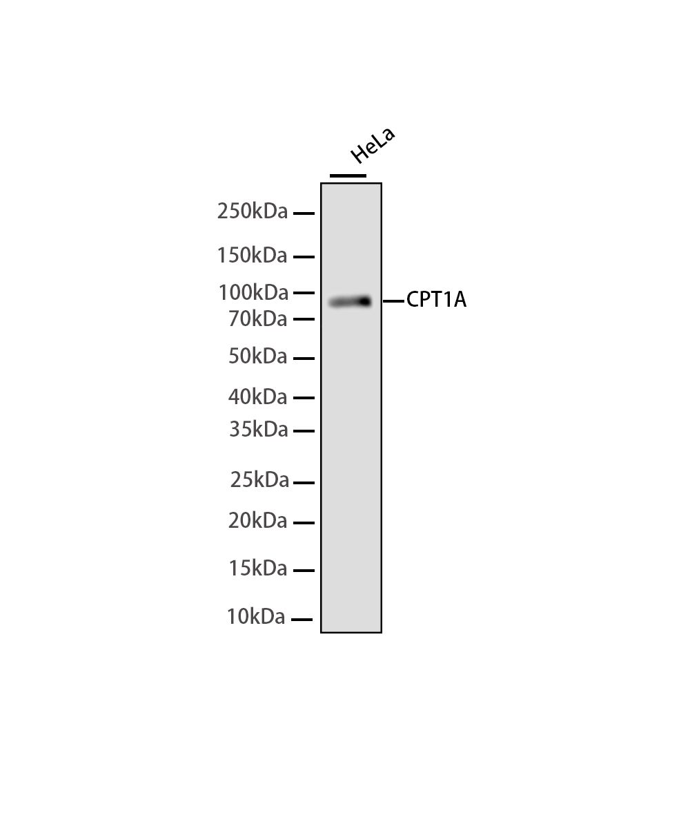 Rabbit monoclonal antibody