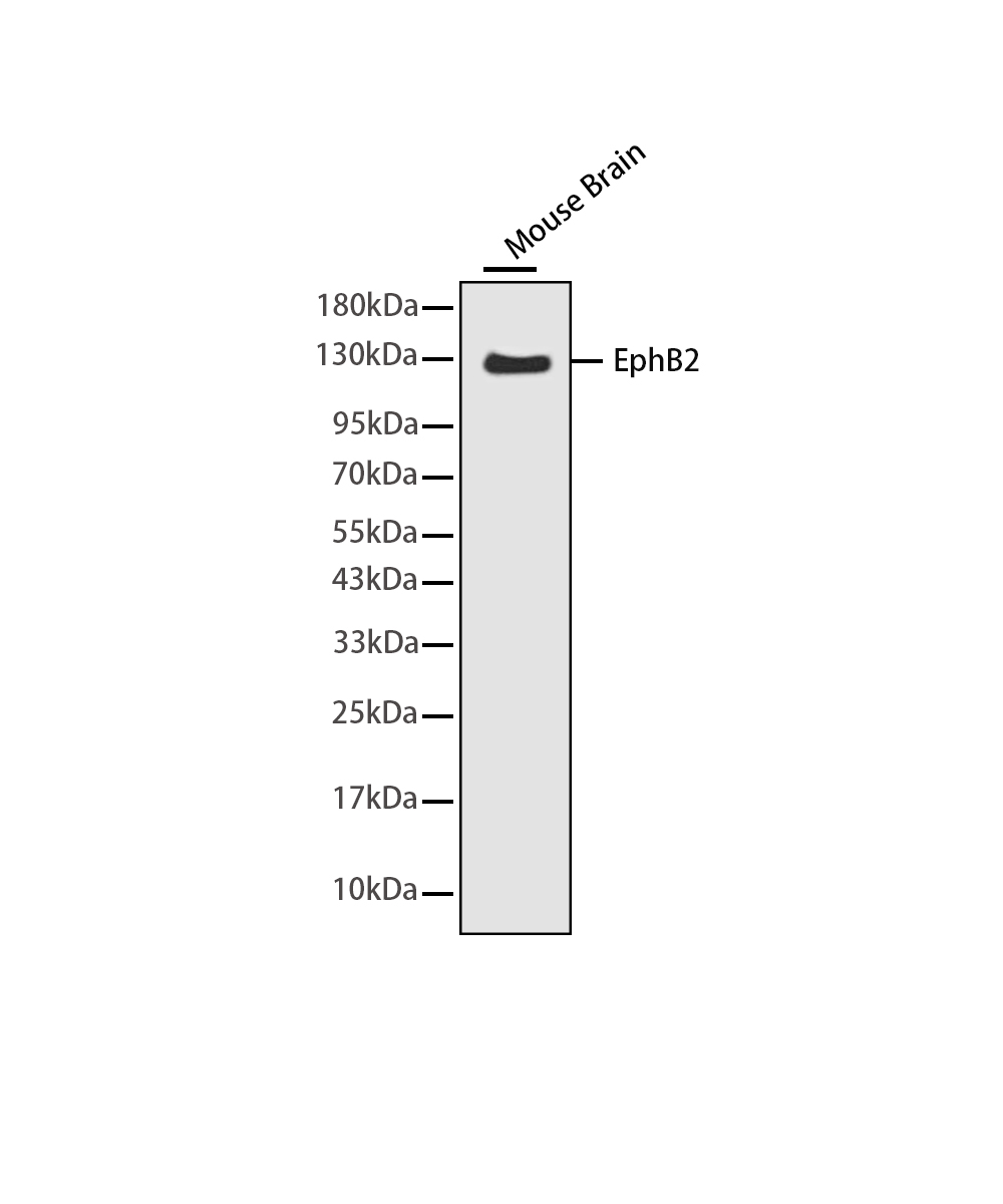 Rabbit monoclonal antibody