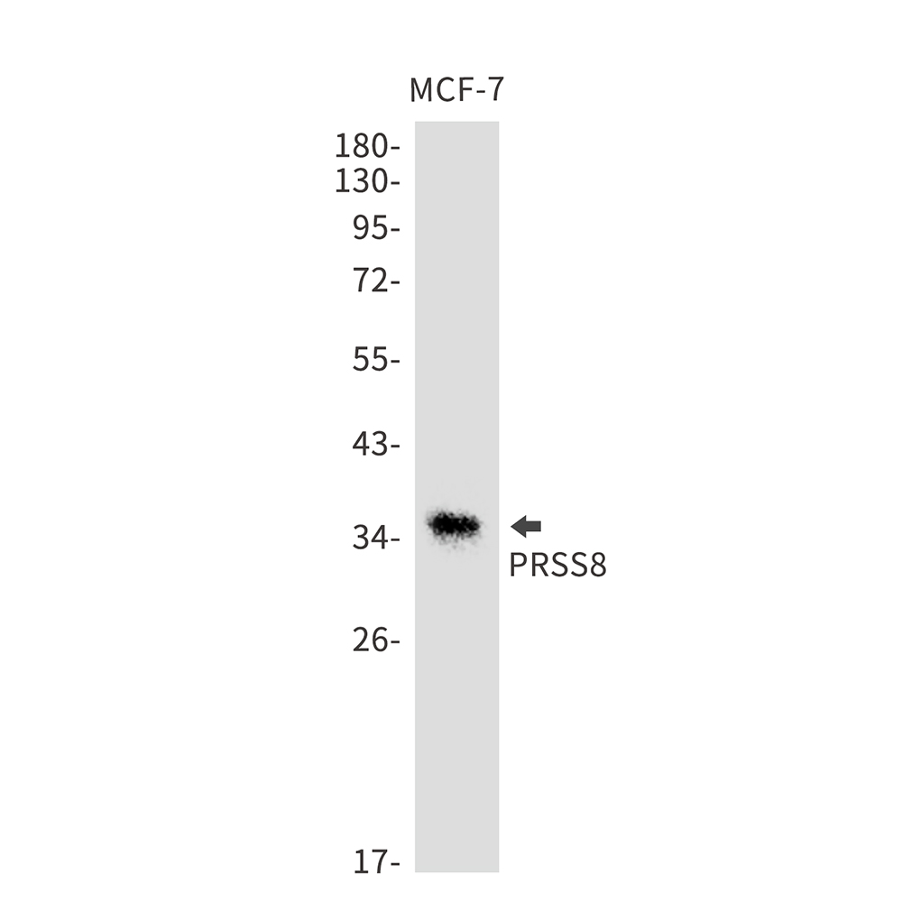 Rabbit monoclonal antibody