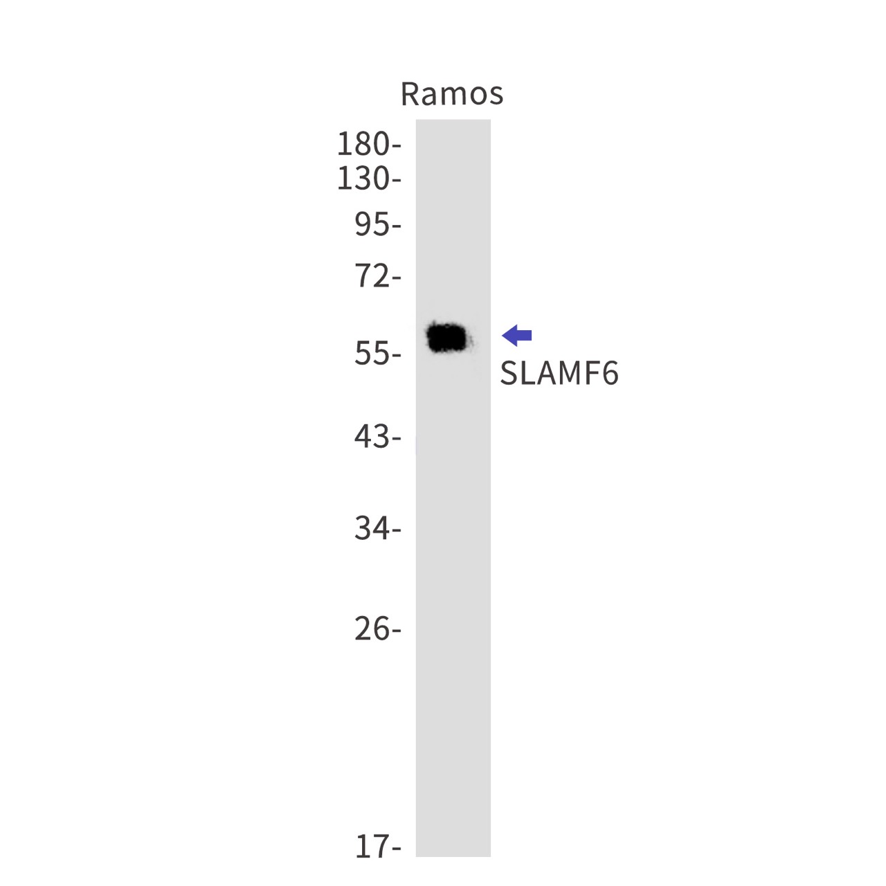 Rabbit monoclonal antibody