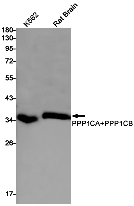 Rabbit monoclonal antibody