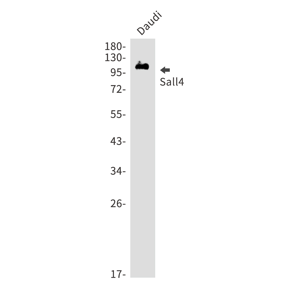 Rabbit monoclonal antibody