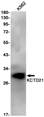 Rabbit monoclonal antibody