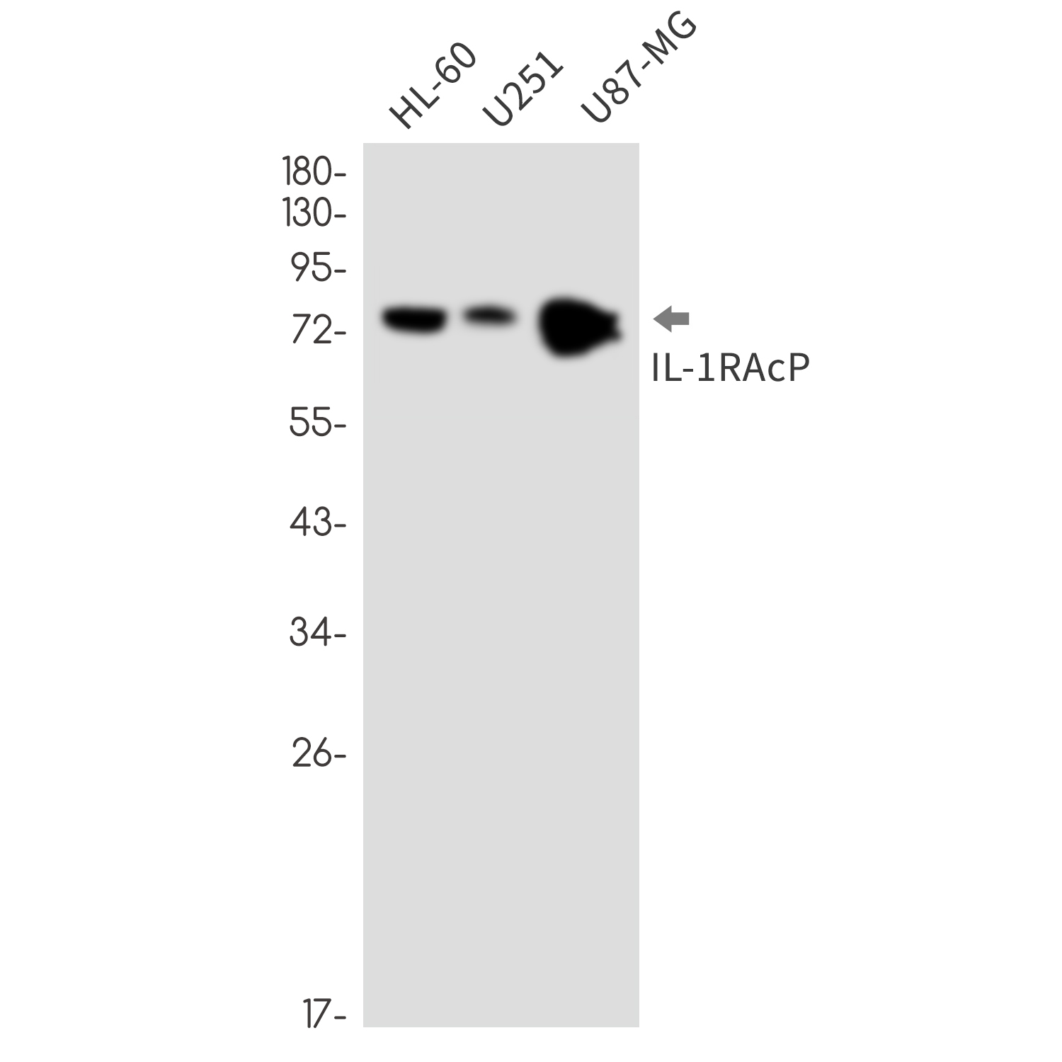 Rabbit monoclonal antibody